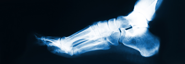 Chiropractic Frederick MD Accident injury Chiropractic Frederick MD Accident injury